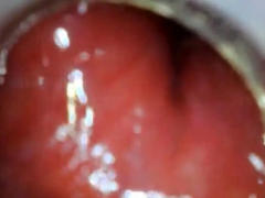 anal endoscope ass play from inside