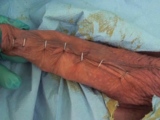 Penis Stapling for slave Renne Part1