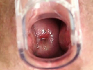 Hairy Grandma Enema During A Medical Exam