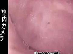 Subtitled Japanese medical clinic internal vagina camera