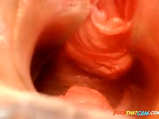 Pussy Close Up And Speculum Pussy Close Up And Speculum