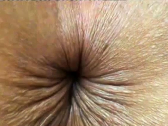 close up butthole winking