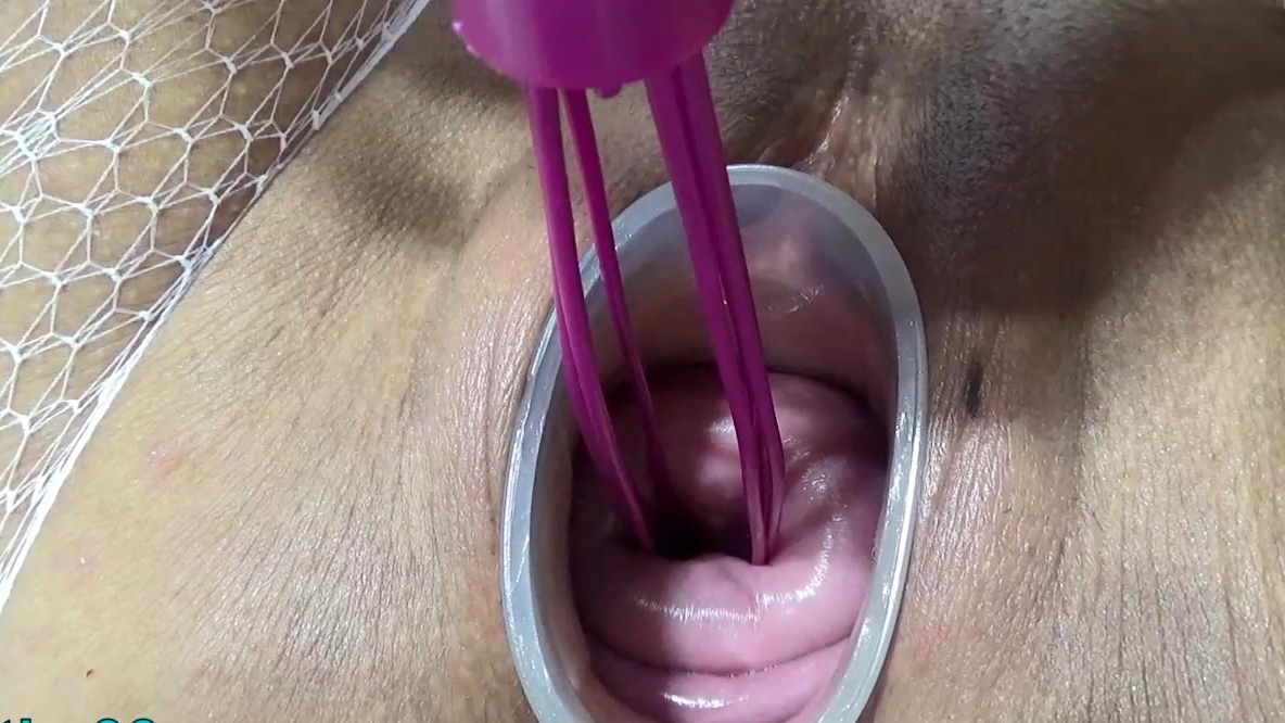 Mature wife fucking cervix and penetration in uterus